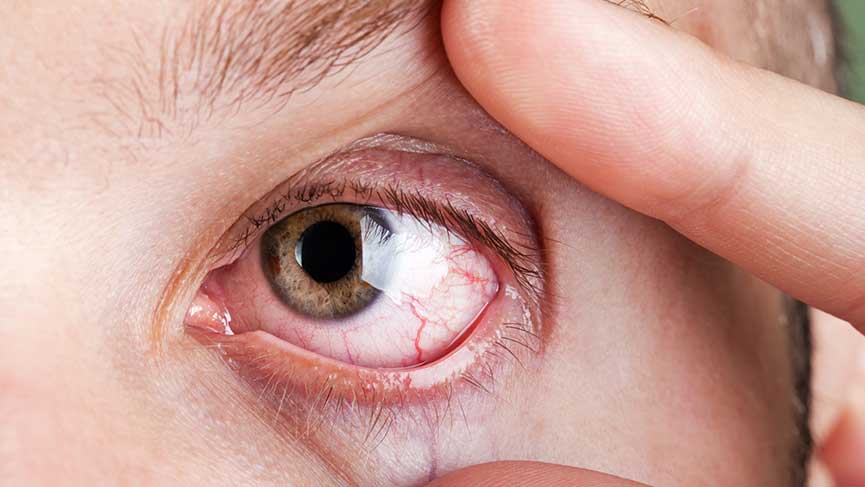 Erişkin Retina Hastalıkları ve Tedavisi