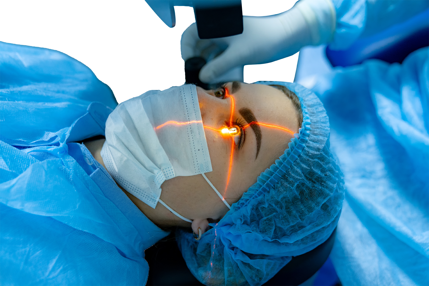 Excimer Lazer