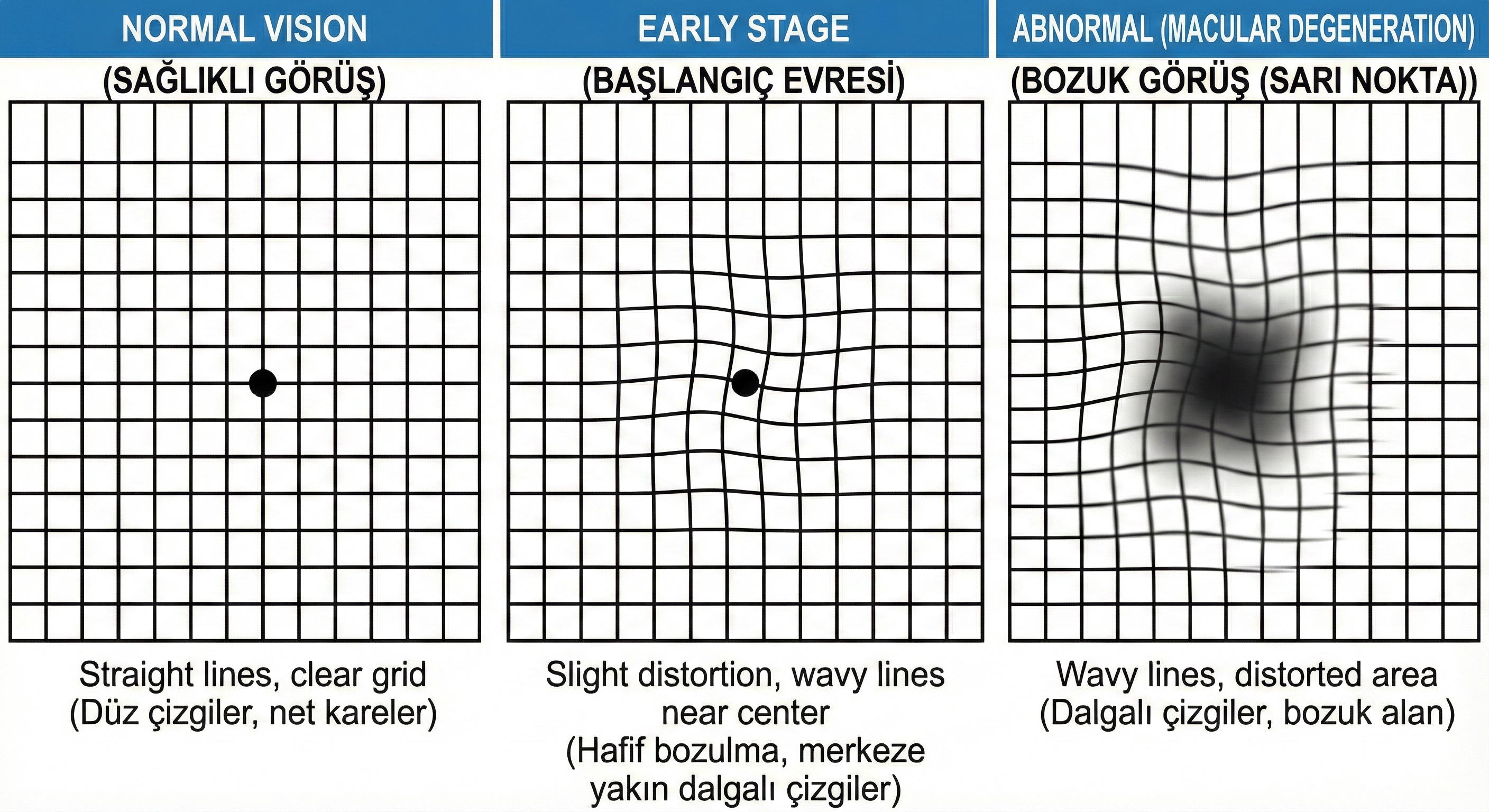 Retina Damar